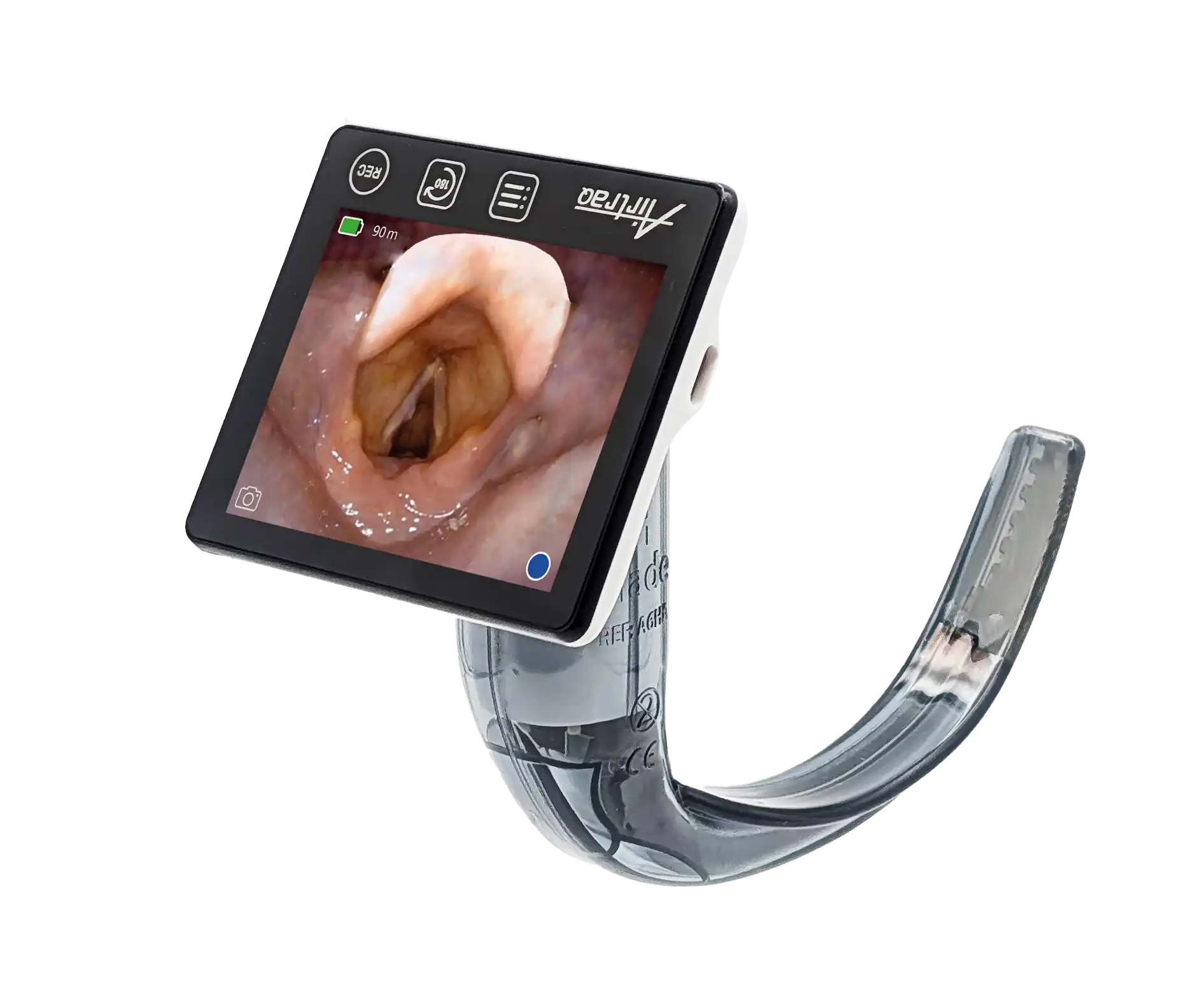 Video laryngoscope showing vocal cords on screen during intubation