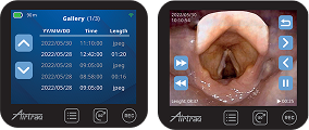 Airtraq monitor interface showing gallery and airway video.