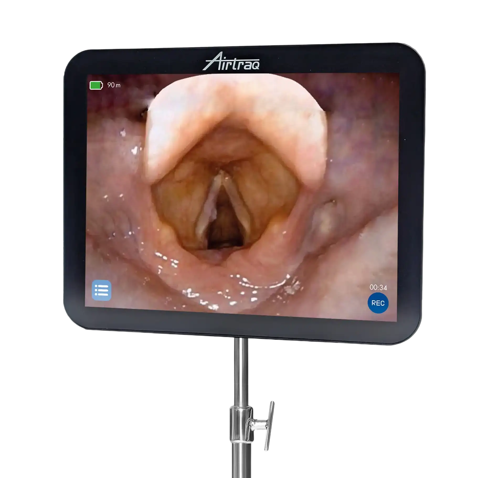 Close-up of the Airtraq Max View monitor displaying glottis view during laryngoscopy.